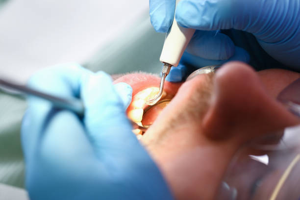 Best Urgent Tooth Repair  in Seville, FL