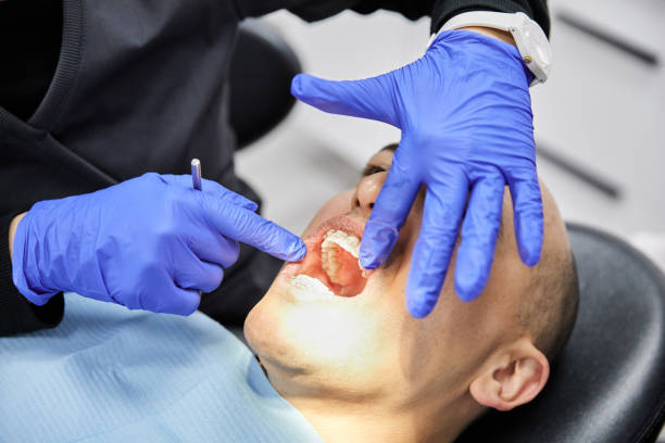 Best Chipped Tooth Repair Near Me  in Seville, FL